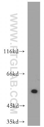 ATF4 Antibody in Western Blot (WB)