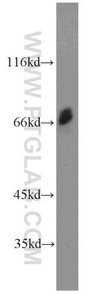 OPTN Antibody in Western Blot (WB)