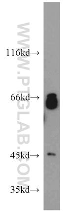 OPTN Antibody in Western Blot (WB)