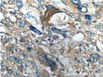 OPTN Antibody in Immunohistochemistry (Paraffin) (IHC (P))