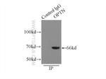 OPTN Antibody in Immunoprecipitation (IP)