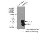 DNAJB2 Antibody in Immunoprecipitation (IP)