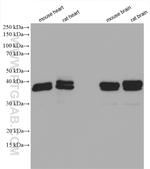 DNAJB2 Antibody in Western Blot (WB)