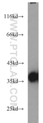 DNAJB2 Antibody in Western Blot (WB)