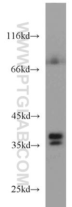 DNAJB2 Antibody in Western Blot (WB)