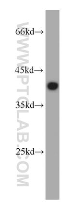 DNAJB2 Antibody in Western Blot (WB)