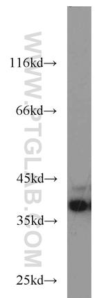 DNAJB2 Antibody in Western Blot (WB)