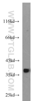 DNAJB2 Antibody in Western Blot (WB)