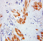 TADA3L Antibody in Immunohistochemistry (Paraffin) (IHC (P))