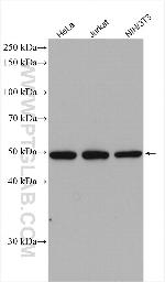 TADA3L Antibody in Western Blot (WB)