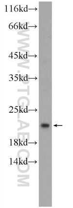 RAP1B Antibody in Western Blot (WB)