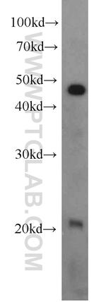 RAP1B Antibody in Western Blot (WB)