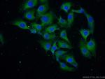 alpha-synuclein Antibody in Immunocytochemistry (ICC/IF)