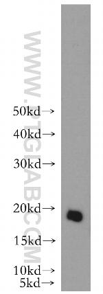 alpha-synuclein Antibody in Western Blot (WB)