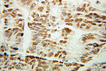 ANP32B Antibody in Immunohistochemistry (Paraffin) (IHC (P))