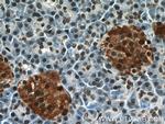 ANP32B Antibody in Immunohistochemistry (Paraffin) (IHC (P))