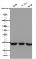 ANP32B Antibody in Western Blot (WB)