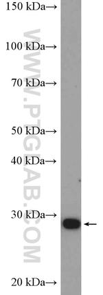 ANP32B Antibody in Western Blot (WB)