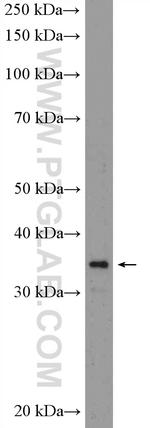 ANP32B Antibody in Western Blot (WB)