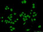 ANP32B Antibody in Immunocytochemistry (ICC/IF)