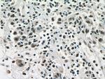 ANP32B Antibody in Immunohistochemistry (Paraffin) (IHC (P))