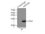 ANP32B Antibody in Immunoprecipitation (IP)