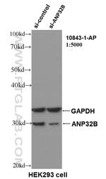 ANP32B Antibody in Western Blot (WB)