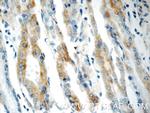 IL1RA Antibody in Immunohistochemistry (Paraffin) (IHC (P))