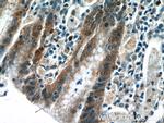 IL1RA Antibody in Immunohistochemistry (Paraffin) (IHC (P))