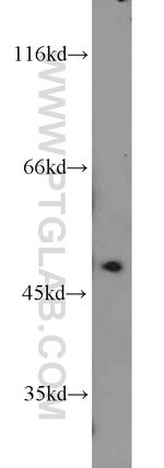 MST4 Antibody in Western Blot (WB)