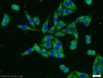 FOXO3A Antibody in Immunocytochemistry (ICC/IF)