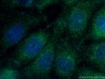 FOXO3A Antibody in Immunocytochemistry (ICC/IF)