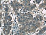 FOXO3A Antibody in Immunohistochemistry (Paraffin) (IHC (P))