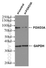 FOXO3A Antibody in Western Blot (WB)