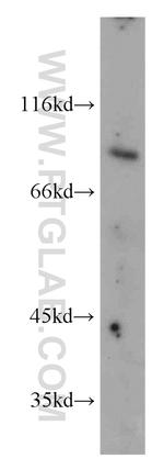 FOXO3A Antibody in Western Blot (WB)