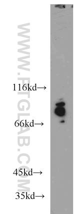 FOXO3A Antibody in Western Blot (WB)