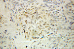 TRIM11 Antibody in Immunohistochemistry (Paraffin) (IHC (P))