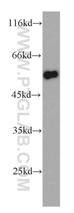 TRIM11 Antibody in Western Blot (WB)