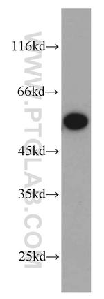 TRIM11 Antibody in Western Blot (WB)