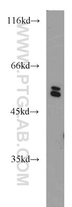 TRIM11 Antibody in Western Blot (WB)