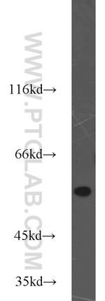 TRIM11 Antibody in Western Blot (WB)