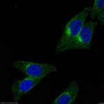 CLTA Antibody in Immunocytochemistry (ICC/IF)