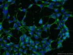 CLTA Antibody in Immunocytochemistry (ICC/IF)