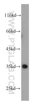 CLTA Antibody in Western Blot (WB)