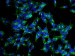 CLTA Antibody in Immunocytochemistry (ICC/IF)