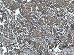 CLTA Antibody in Immunohistochemistry (Paraffin) (IHC (P))