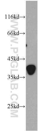 CLTA Antibody in Western Blot (WB)