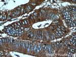 Palladin Antibody in Immunohistochemistry (Paraffin) (IHC (P))