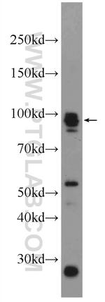 Palladin Antibody in Western Blot (WB)