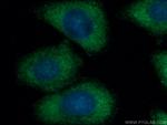 JP45/JSRP1 Antibody in Immunocytochemistry (ICC/IF)